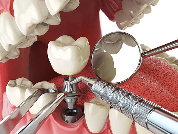 Best Emergency Gum Treatment in Azusa, CA